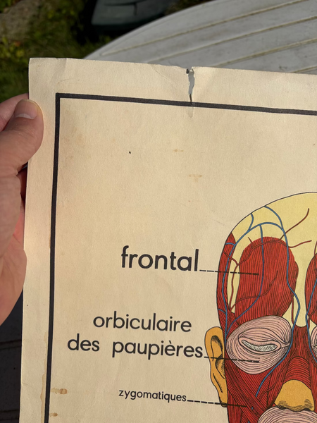 Affiche pédagogique scolaire Rossignol vintage / Les muscles / Cyphose et scoliose