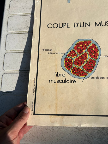 Affiche pédagogique scolaire Rossignol vintage / Les muscles / Cyphose et scoliose
