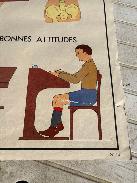 Affiche pédagogique scolaire Rossignol vintage / Les muscles / Cyphose et scoliose