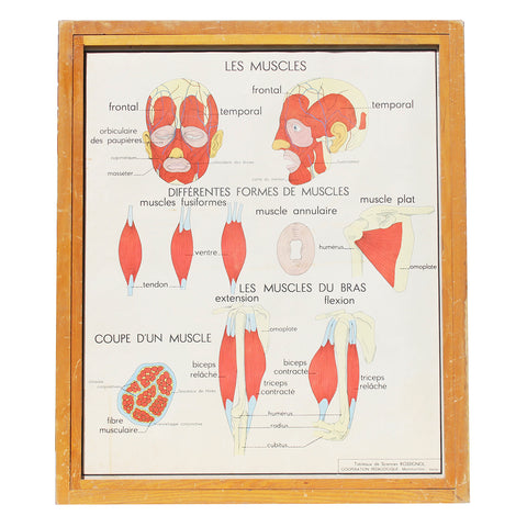 Affiche pédagogique scolaire Rossignol vintage / Les muscles / Cyphose et scoliose