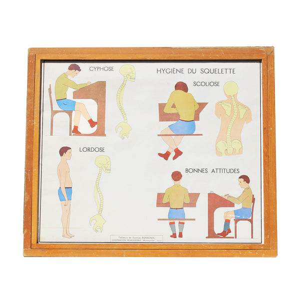 Affiche pédagogique scolaire Rossignol vintage / Les muscles / Cyphose et scoliose